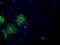 ATP Citrate Lyase antibody, MA5-25067, Invitrogen Antibodies, Immunocytochemistry image 