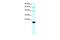 Claudin 23 antibody, GTX77846, GeneTex, Western Blot image 