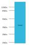 Galactose-1-Phosphate Uridylyltransferase antibody, LS-C317816, Lifespan Biosciences, Western Blot image 