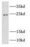 RAB2B, Member RAS Oncogene Family antibody, FNab07013, FineTest, Western Blot image 