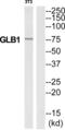 Galactosidase Beta 1 antibody, abx014265, Abbexa, Western Blot image 