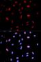 Mitogen-Activated Protein Kinase Kinase 6 antibody, LS-C335771, Lifespan Biosciences, Immunofluorescence image 