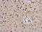 Protein Disulfide Isomerase Family A Member 3 antibody, GTX100297, GeneTex, Immunohistochemistry paraffin image 