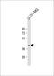 Patatin Like Phospholipase Domain Containing 5 antibody, 61-311, ProSci, Western Blot image 