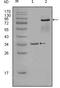 EPH Receptor A7 antibody, MA5-15457, Invitrogen Antibodies, Western Blot image 