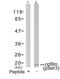 Cofilin 1 antibody, GTX50199, GeneTex, Western Blot image 