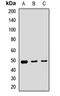 Glutaryl-CoA Dehydrogenase antibody, LS-C667817, Lifespan Biosciences, Western Blot image 