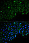 Hexokinase 2 antibody, STJ24020, St John