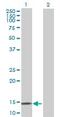 Retinoic Acid Receptor Responder 2 antibody, ab72965, Abcam, Western Blot image 