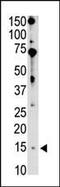 BCL2 Interacting Killer antibody, MBS9208005, MyBioSource, Western Blot image 