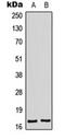 Membrane Palmitoylated Protein 2 antibody, orb341140, Biorbyt, Western Blot image 