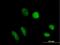 TruB Pseudouridine Synthase Family Member 1 antibody, H00142940-B01P, Novus Biologicals, Immunofluorescence image 