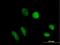TruB Pseudouridine Synthase Family Member 1 antibody, H00142940-B01P, Novus Biologicals, Immunofluorescence image 
