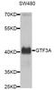 General Transcription Factor IIIA antibody, A8426, ABclonal Technology, Western Blot image 