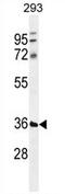 Transmembrane and coiled-coil domain-containing protein 5B antibody, AP54283PU-N, Origene, Western Blot image 