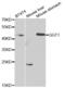 Gamma-Glutamyltransferase 1 antibody, abx001473, Abbexa, Western Blot image 