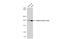 Clathrin Heavy Chain antibody, GTX132976, GeneTex, Western Blot image 