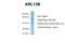 ADP Ribosylation Factor Like GTPase 13B antibody, A04279, Boster Biological Technology, Western Blot image 