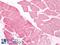 Ubiquitin C-Terminal Hydrolase L3 antibody, LS-A8557, Lifespan Biosciences, Immunohistochemistry paraffin image 