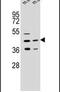 Acyl-CoA Wax Alcohol Acyltransferase 2 antibody, PA5-24313, Invitrogen Antibodies, Western Blot image 