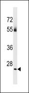 TBC1 Domain Family Member 26 antibody, 60-883, ProSci, Western Blot image 