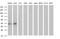 Malonyl-CoA-Acyl Carrier Protein Transacylase antibody, MA5-26315, Invitrogen Antibodies, Western Blot image 