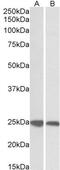 Growth Factor Receptor Bound Protein 2 antibody, 45-066, ProSci, Immunohistochemistry paraffin image 