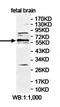 Zinc Finger Protein 394 antibody, orb78375, Biorbyt, Western Blot image 