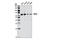 Succinate Dehydrogenase Complex Flavoprotein Subunit A antibody, 5839S, Cell Signaling Technology, Western Blot image 