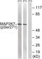 Mitogen-Activated Protein Kinase Kinase 7 antibody, 79-855, ProSci, Western Blot image 
