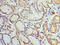 Histone Cluster 2 H3 Family Member D antibody, CSB-PA744479HA01HU, Cusabio, Immunohistochemistry paraffin image 