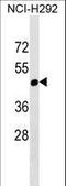 Ral Guanine Nucleotide Dissociation Stimulator Like 4 antibody, LS-C158841, Lifespan Biosciences, Western Blot image 