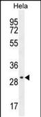 EMG1 N1-Specific Pseudouridine Methyltransferase antibody, PA5-48126, Invitrogen Antibodies, Western Blot image 