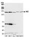 WIZ Zinc Finger antibody, A305-864A-M, Bethyl Labs, Western Blot image 