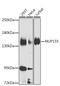 Nucleoporin 155 antibody, GTX33372, GeneTex, Western Blot image 