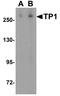 Telomerase Associated Protein 1 antibody, A02017, Boster Biological Technology, Western Blot image 