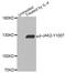 Janus Kinase 2 antibody, STJ29360, St John
