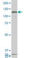 Guanylate Cyclase 2C antibody, H00002984-M02, Novus Biologicals, Western Blot image 