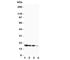 Fibroblast Growth Factor 1 antibody, R30107, NSJ Bioreagents, Western Blot image 