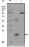 Insulin Like Growth Factor Binding Protein 2 antibody, abx010964, Abbexa, Enzyme Linked Immunosorbent Assay image 