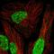 Meis Homeobox 1 antibody, HPA058641, Atlas Antibodies, Immunofluorescence image 