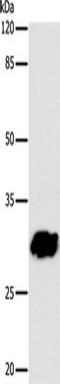 Gap Junction Protein Beta 6 antibody, TA321786, Origene, Western Blot image 