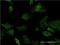 Distal-Less Homeobox 5 antibody, H00001749-M09, Novus Biologicals, Immunofluorescence image 