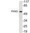 Pyruvate Kinase M1/2 antibody, A30919, Boster Biological Technology, Western Blot image 