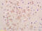 Unc-80 Homolog, NALCN Channel Complex Subunit antibody, GTX51241, GeneTex, Immunohistochemistry paraffin image 