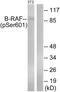 B-Raf Proto-Oncogene, Serine/Threonine Kinase antibody, PA5-38412, Invitrogen Antibodies, Western Blot image 