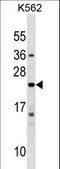 Interferon Alpha 10 antibody, LS-C159883, Lifespan Biosciences, Western Blot image 