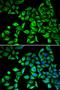 C-Reactive Protein antibody, orb129574, Biorbyt, Immunofluorescence image 