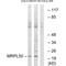 Mitochondrial Ribosomal Protein L50 antibody, A17223, Boster Biological Technology, Western Blot image 