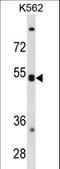 C-X-C chemokine receptor type 5 antibody, LS-C157671, Lifespan Biosciences, Western Blot image 